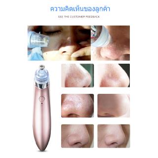 ✿เครื่องดูดสิวเสี้ยนทำความสะอาดรูขุมขน