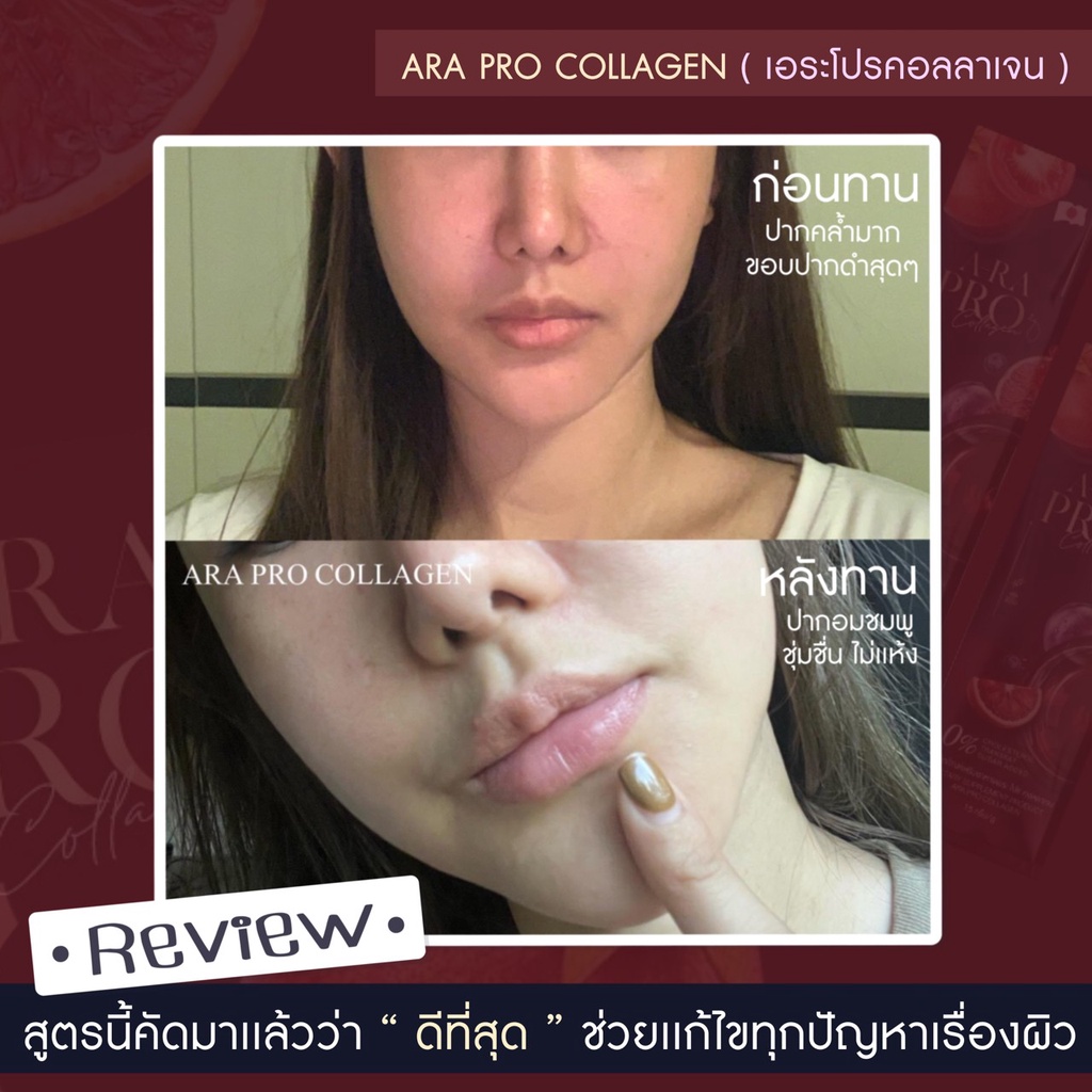 ภาพสินค้าARA PRO COLLAGEN3+ เปิดไฟผิวขาวโกลว์ บำรุงผิว ผม ดวงตา เล็บ กระดูกและข้อต่อ ลดรอยสิว ลดผมร่วง (บริษัทโดยตรง) จากร้าน arabrand บน Shopee ภาพที่ 7