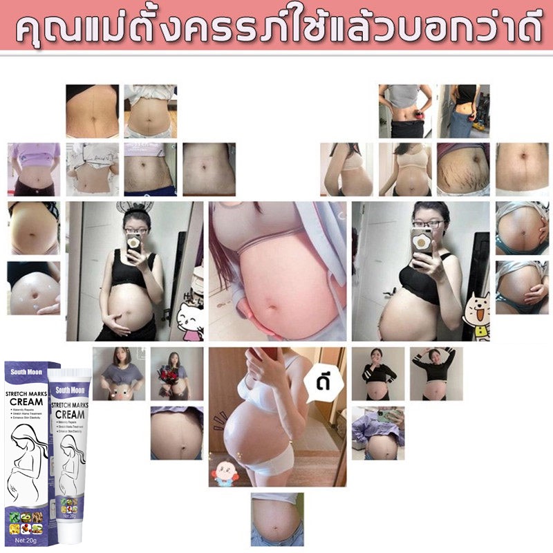 ของแท้100-ครีมลดรอยแตก-ซ่อมรอยแตกลาย-ลดการเกิดรอยแตกลาย-ปรับผิว-เลือนริ้วรอยอย่างรวดเร็ว-คืนความเรียบเนียนของหน้าท้อง-ครีมทาท้องลาย-ครีมลดรอยแตกลาย-ลดผิวแตกลาย-แก้แตกลาย-ครีมทาขาแตกลาย-ครีมแก้ท้องลาย-