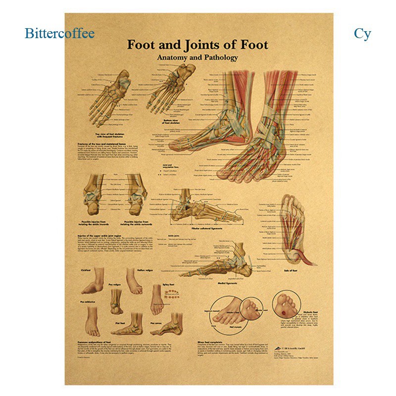 bittercoffee-ภาพโปสเตอร์ติดผนัง-แผนภูมิกายวิภาคพยาธิวิทยา-สําหรับตกแต่งบ้าน