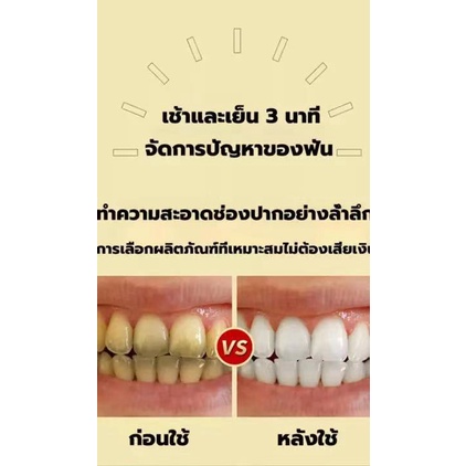 ยาสีฟันพิษผึ้งbeevenom-ยาสีฟันฟอกฟันขาว-ขจัดหินปูน-คราบเหลือง-กำจัดกลิ่นปาก-ลดอาการเสียวฟัน-ยาสีฟันสมุนไพรแก้ปากเหม็น