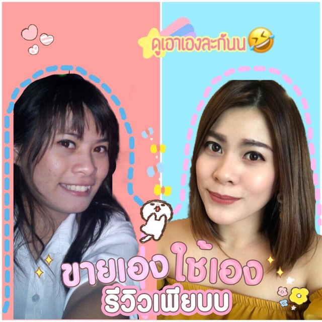 ลาเบลล่าครีม-รักษาสิวเพื่อผิวหน้าใส