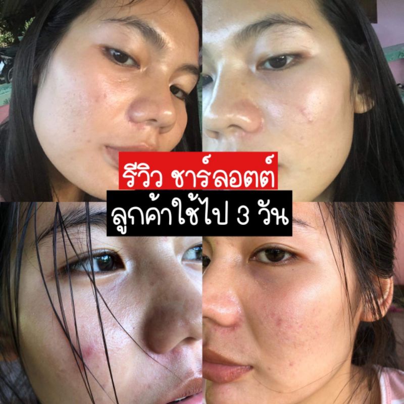 ชาลอตต์-หน้าใส15กรัม-ของแท้-ขายเท