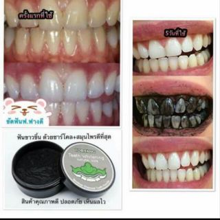 ผงขัดฟันชาร์โคล ฟ.ฟาง FOR FANG TEETH WHITENING