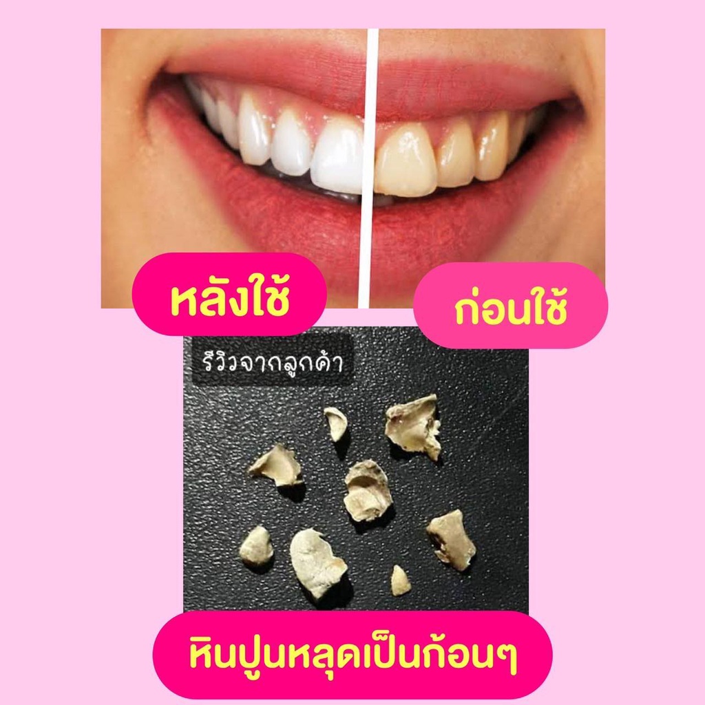 ยาสีฟันดีพราว-1-แถม-1-ยาสีฟันฟอกฟันขาว-deproud-premium-dental-care-toothpaste-ยาสีฟัน-ดีพราวด์-กลิ่นปาก-ฟันเหลือง