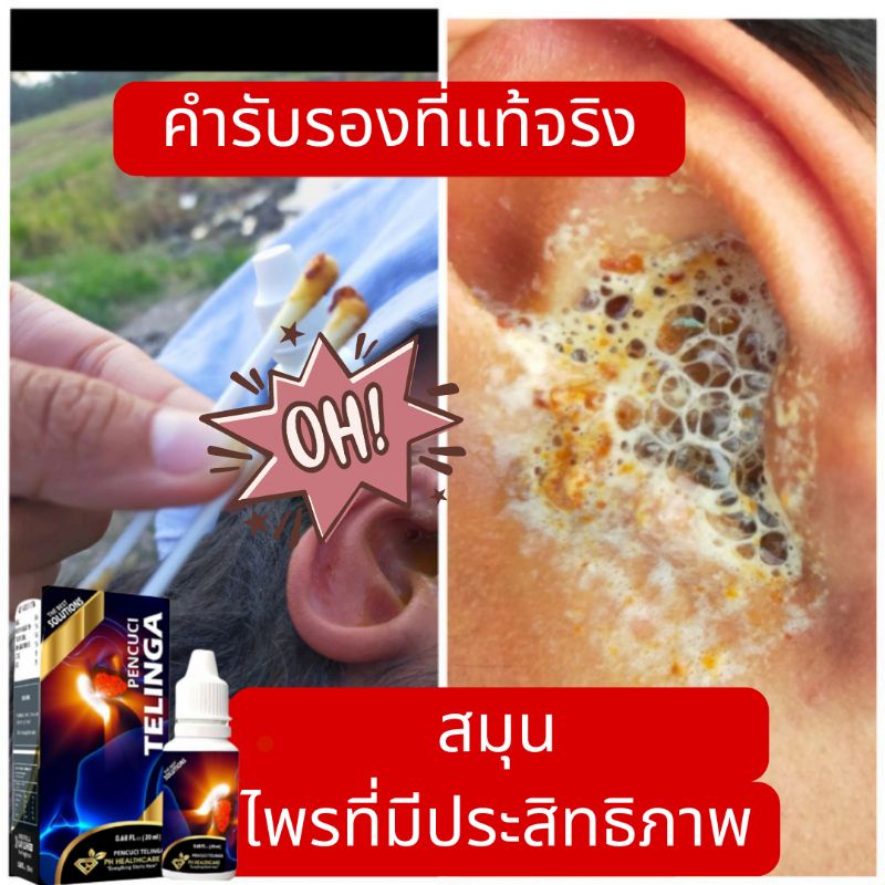 สมุนไพรแท้ ยาหยอดหู หูหนวก หูอื้อ น้ำในหู ขี้หู คันหู หนองในหู หูอื้อ  น้ำยาทำความสะอาดหู 20มล Ear Cleanser | Shopee Thailand