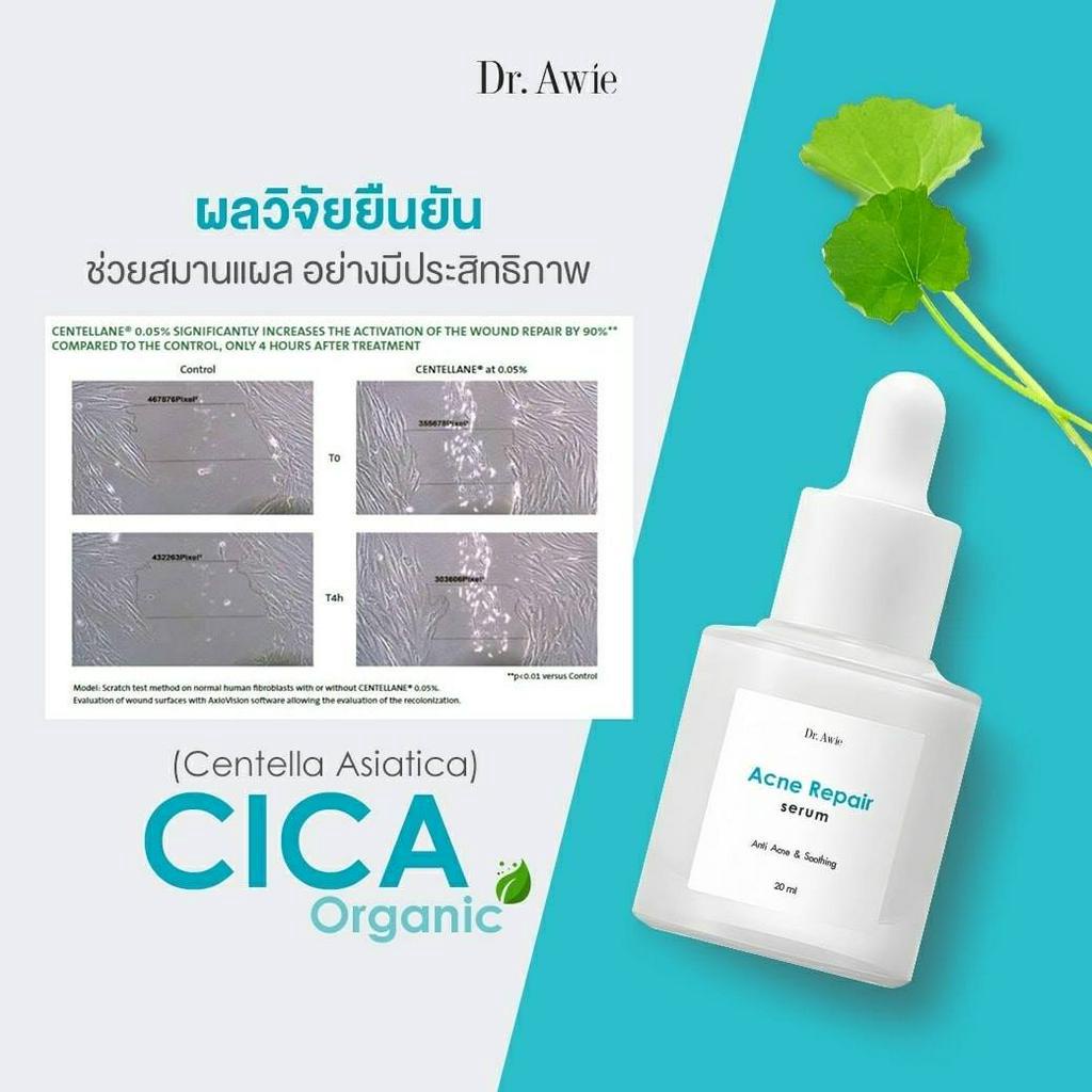 เซรั่มลดสิว-dr-awie-acne-repair-serum-เซรั่มเข้มข้น-สำหรับปัญหาสิว-ช่วยดูแลปัญหาสิวอักเสบ-สิวอุดตัว-สิวฮอร์โมน