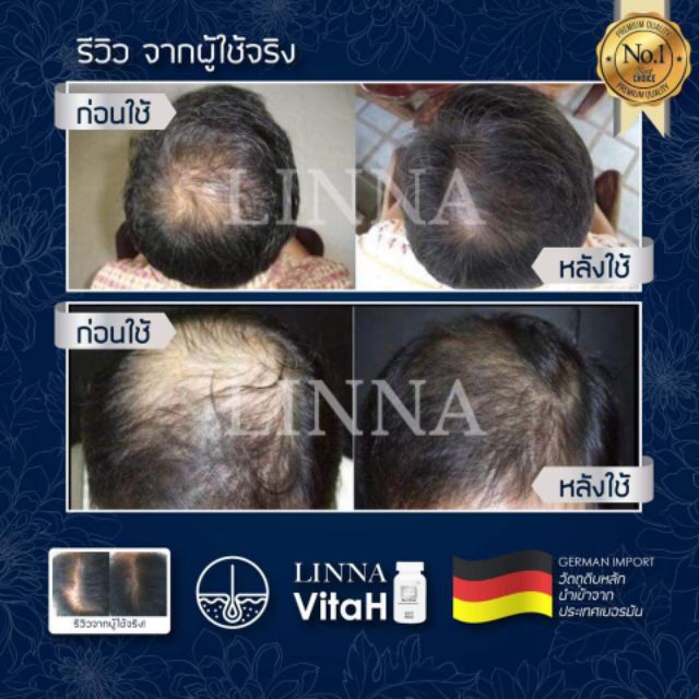 linna-vitah-วิตามินผมหางม้า-ลินนาแฮร์เซรั่ม-linna-hair-serum-แชมพู-shampoo