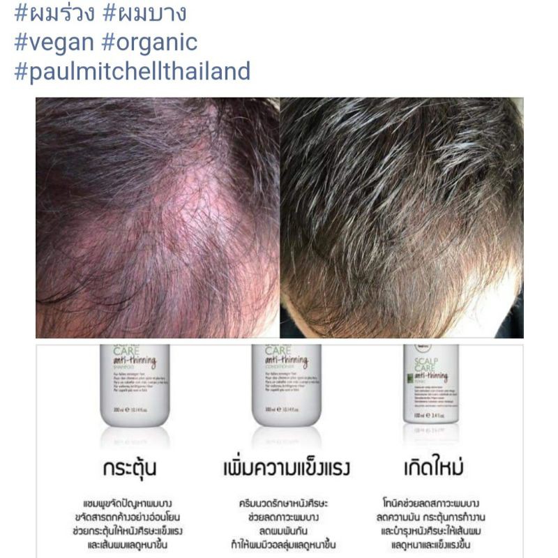 โทนิคกระตุ้นรากผม-พอล-มิทเชล-paul-mitchell-tea-tree-scalp-care-anti-thinning-tonic-50ml-พอล-มิทเชล-ทีทรี