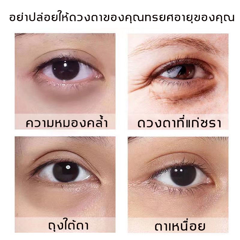 onespring-อายครีม-ครีมบำรุงใต้ตา-ครีมลดถุงใต้ตา-แก้ขอบตาดำ-ลบคล้ำบวมใต้ตา-แบ่งเบาริ้วรอย-ขอบตาดำ-ครีมลดขอบตาดำ-eye-cream