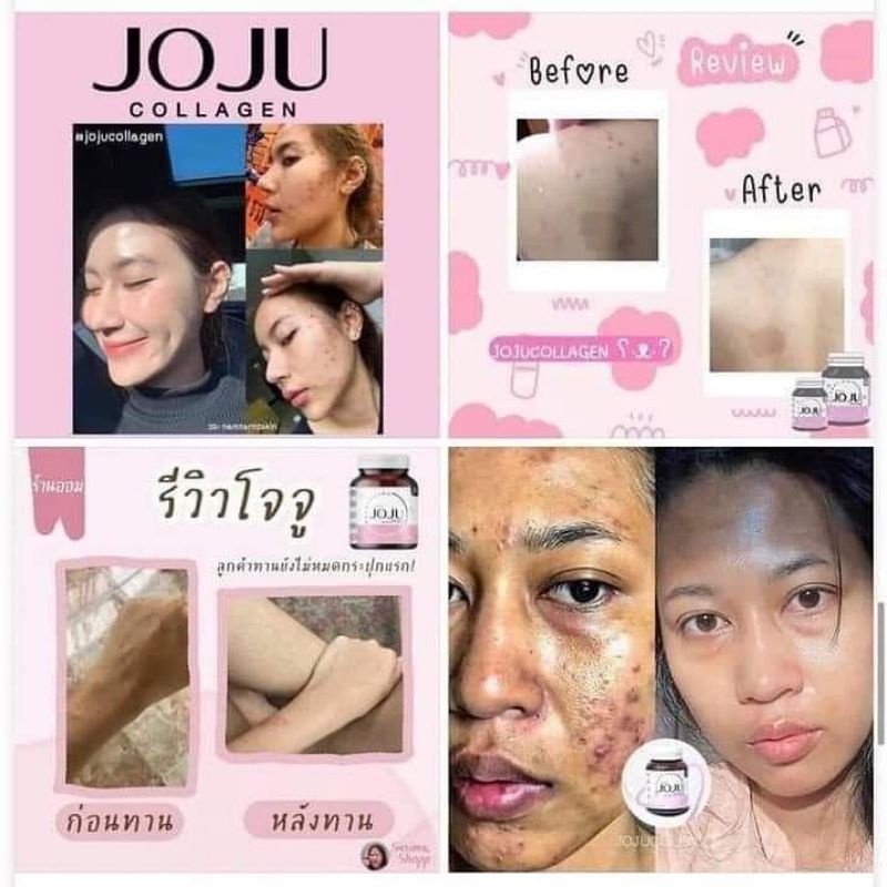 ถูก-แท้100-โจจูคอลลาเจน-joju-collagen