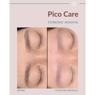 ภาพหน้าปกสินค้าลบคิ้วด้วย Pico Care  พร้อมสักคิ้วใหม่ 6 มิติ , สีฝุ่น ซึ่งคุณอาจชอบสินค้านี้