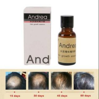 ภาพหน้าปกสินค้าปลูกผม Andrea Hair growth ที่เกี่ยวข้อง