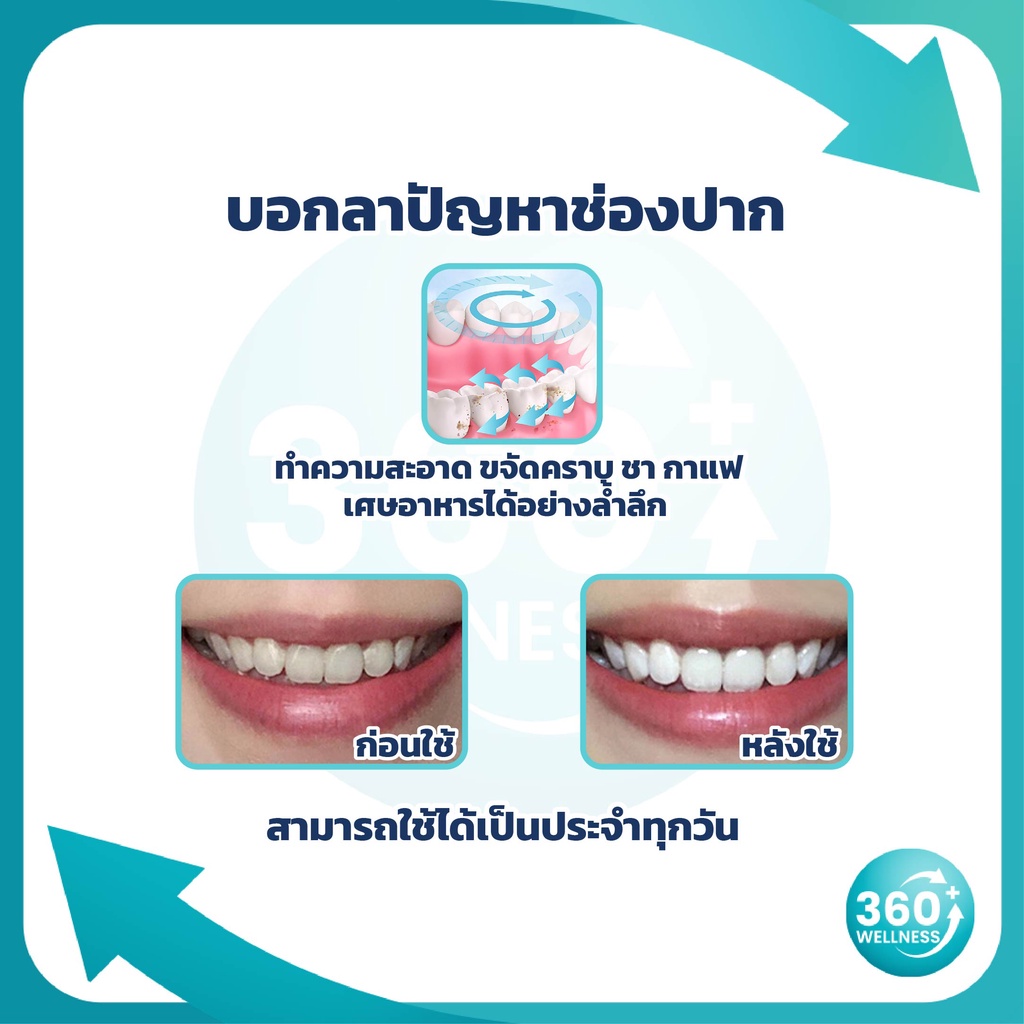 360wellness-ศูนย์รวมอุปกรณ์เพื่อสุขภาพ-ยาสีฟัน-ฟันขาว-ฟอกฟันขาว-ฟอกสีฟัน-อุปกรณ์ทำความสะอาดฟัน-ยาสีฟันแก้ฟันเหลือง