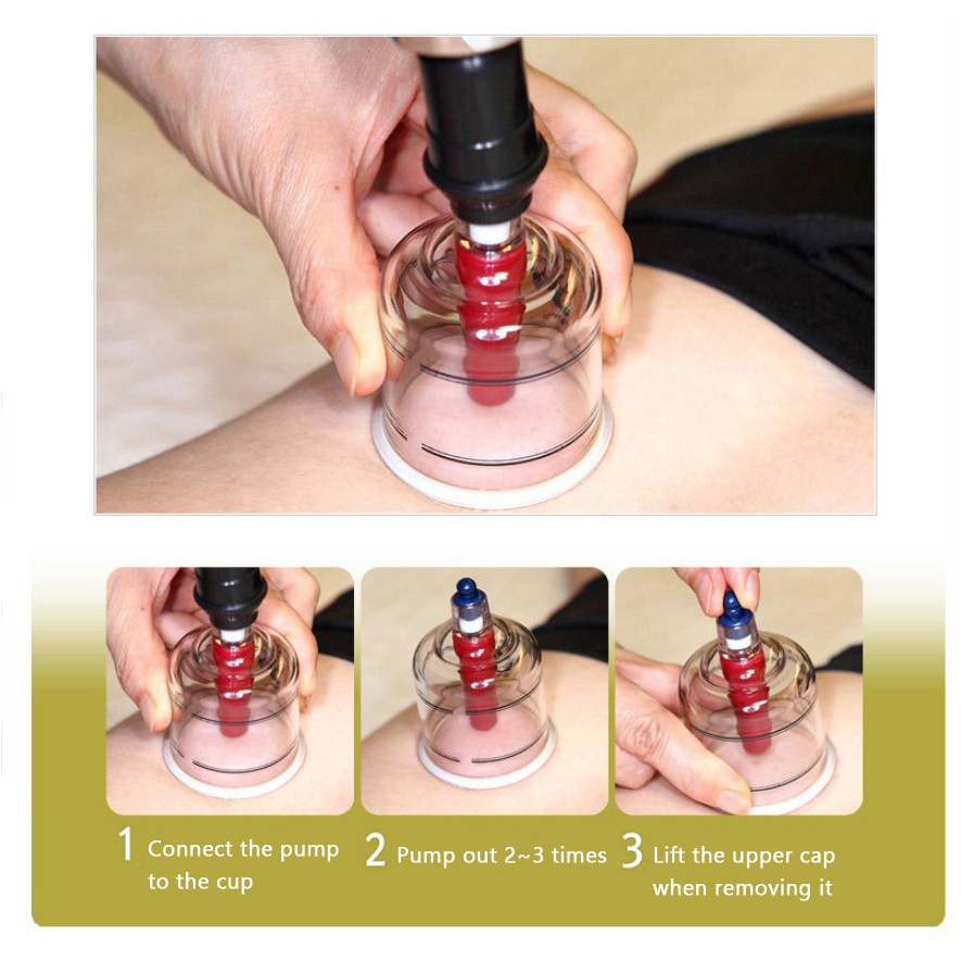 Hansol Buhang Medical Massage Device Professional Cupping 19 ถ้วยชุด ...