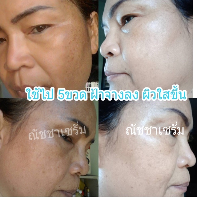 เซรั่มณัชชา-ปรับสูตรใหม่-เข้มข้นกว่าเดิม-ส่งฟรี