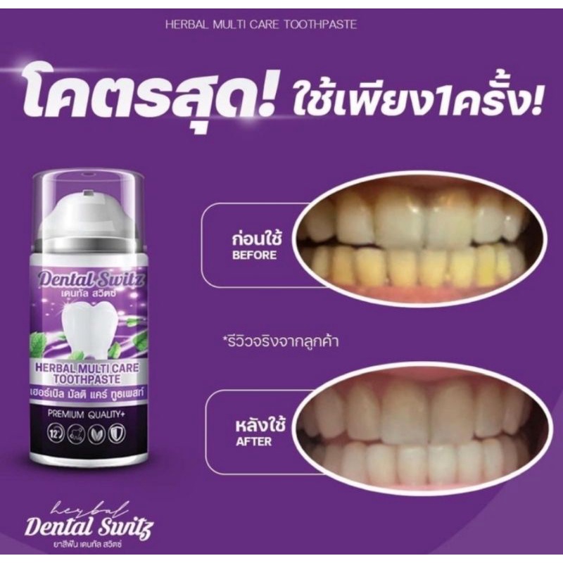 ยาสีฟันฟอกฟันขาว-โปรรรร-1-แถม-1-1-แถม-1-แถมรางฟอก-ท้าพิสูจน์-กลิ่นปาก-หินปูนและคราบเหลืองตามไรฟัน