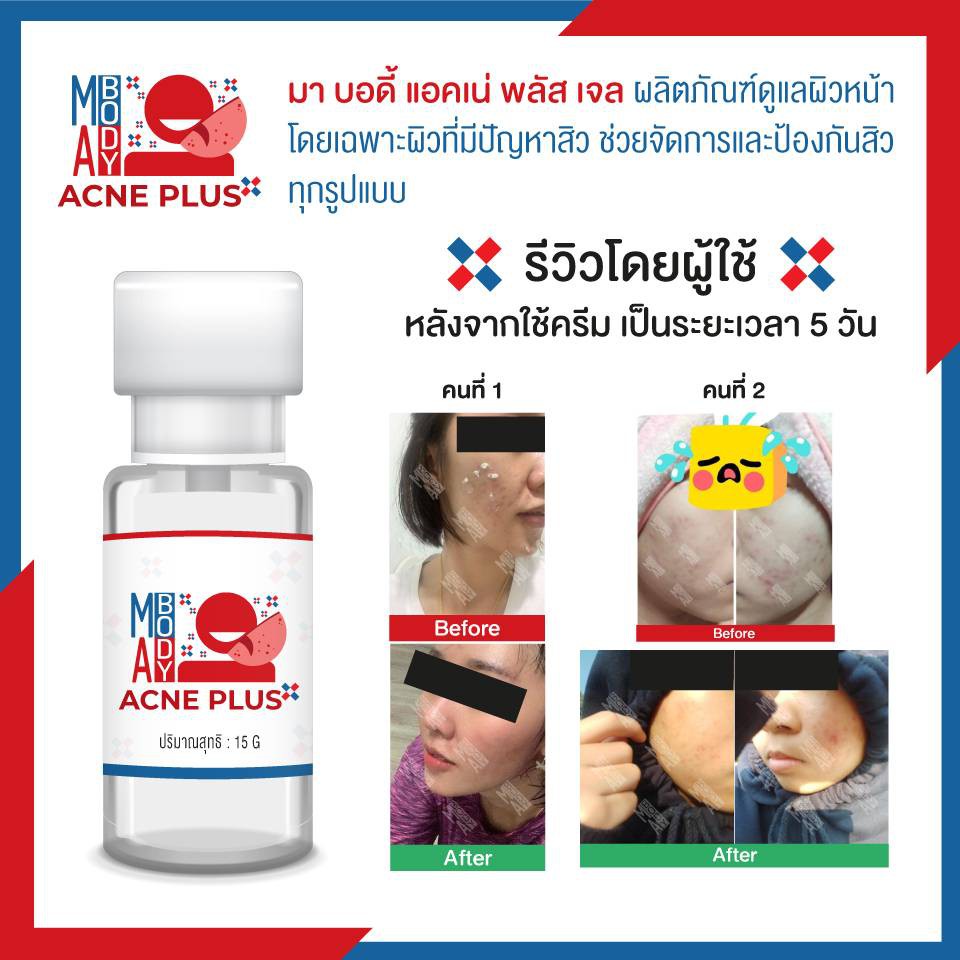 MA BODY ACNE PLUS บำรุงล้ำลึก | Shopee Thailand