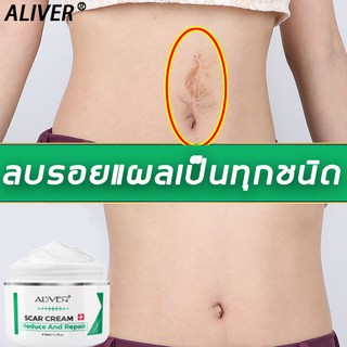 ALIVER ครีมกำจัดรอยแผลเป็น 50ml ทำให้เนื้อเยื่อแผลเป็นนุ่ม สำหรับแผลเป็นทุกประเภท เจลลดรอยแผลเป็น ครีมกำจัดรอยแผลเป็น