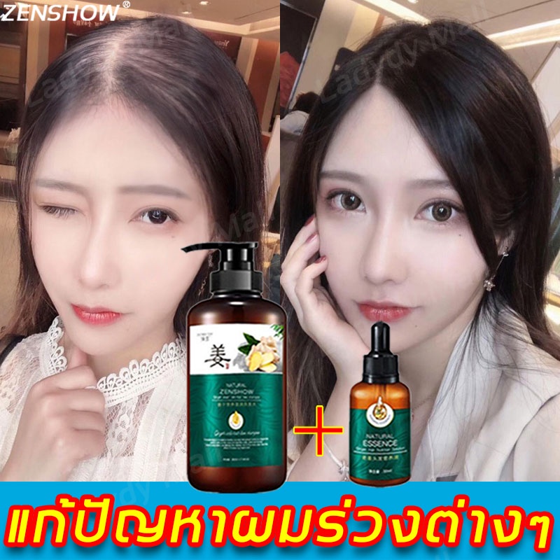 2-ขวด-zenshow-แชมพูแก้ผมร่วง-เซรั่มยาสระผมขิง-สดชื่นคุมมันรากผมแข็งแรง-แก้ปัญหาผมร่วง-แชมพูขิงเพียว-แชมพูแก้ปัญหาผมร่วง