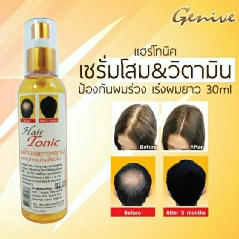 ภาพสินค้าGenive Tonic Hair Spray 120 ml จีนิวี แฮร์โทนิค ลดผมร่วง ปลูกผม เร่งผมยาว จากร้าน hairbeauty_online บน Shopee ภาพที่ 2
