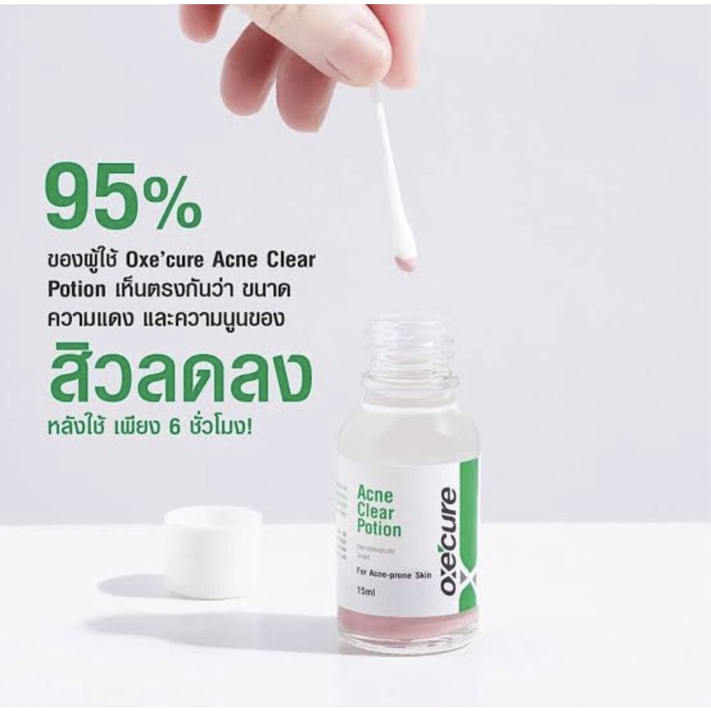 oxecure-acne-clear-potion-อ๊อกซีเคียว-แอคเน่-เคลียร์-โพชั่นแต้มสิว-รักษาสิว-บำรุงผิวหน้า-ขนาด-15-ml