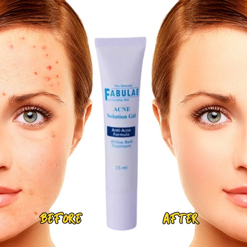 พร้อมส่ง-the-skincare-fabulae-เจลรักษาสิว-เจลล้างหน้า-เจลรักษาสิว-แพ้ง่าย-คลีนซิ่ง-วอเตอร์-fabulae-n9