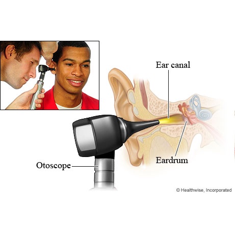 abloom-ชุด-เครื่องตรวจตา-หู-mark-ii-classic-otoscope-ophthalmoscope-diagnostic-set