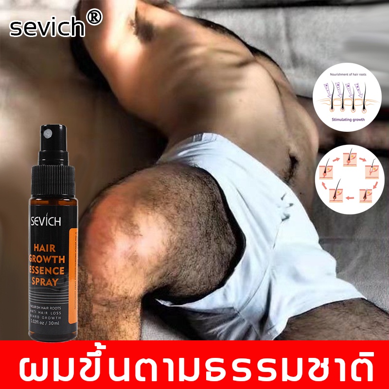 sevich-เซรั่มปลูกเครา-30ml-ปลูกคิ้ว-ปลูกหนวด-ขึ้นถาวร-น้ำยาปลูกเครา-น้ำมันหนวด-น้ำมันเครา-ยาปลูกคิ้ว-ครีมปลูกคิ้ว