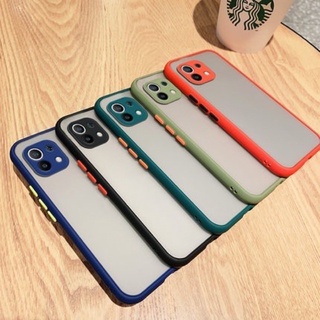 [ส่งจากประเทศไทย] ขอบสีผิวด้าน Case Xiaomi Mi 11 Lite เคสกันกระแทก ขอบนิ่มหลังแข็ง เคสมือถือ สามารถป้องกันกล้อง