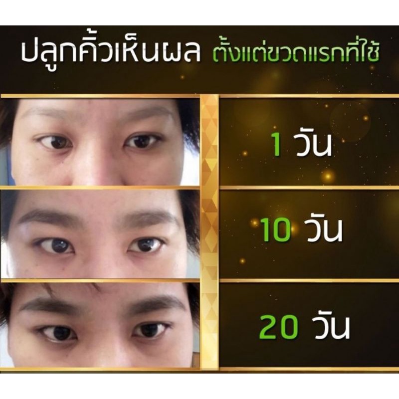 เซรั่มปลูกผมพันธ์ไทย-ปลูกคิ้ว-ปลูกหนวด-ปลูกผม-เห็นผลจริง