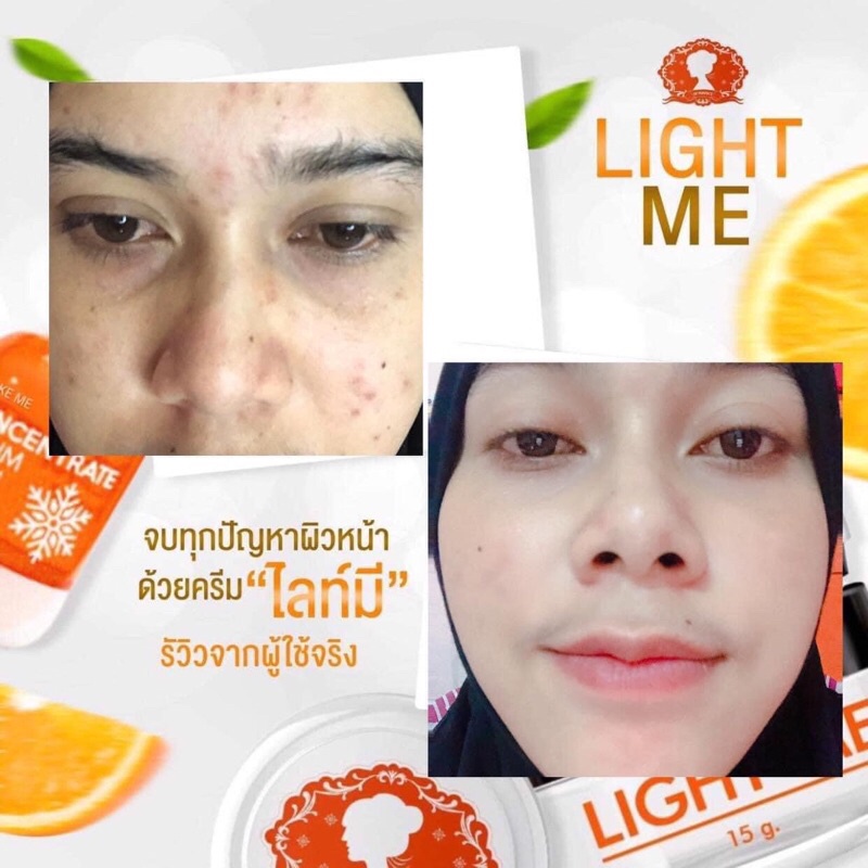 light-me-ไลท์มี-โปรโมชั่น-1-แถม-แบรนด์เดียวกับไลท์ไวท์ครีมทาผิวขาว-light-white-white-white