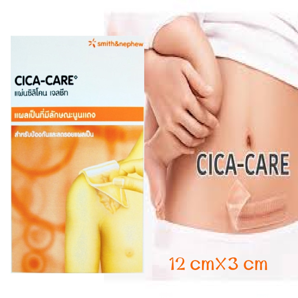 cica-care-ซิลิโคนเจลสำหรับแผลเป็นนูน-แผลผ่าตัด