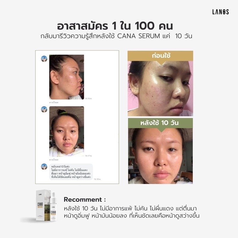 cana-serum-คาน่าเซรั่ม