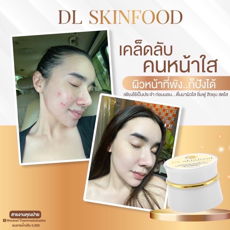 โฉมใหม่-deli-skin-dl-skinfood-ไนท์ครีมบำรุงผิว-ลดรอยสิว-ผิวคล้ำ-ผิวสวยใสไม่ง้อคลินิก