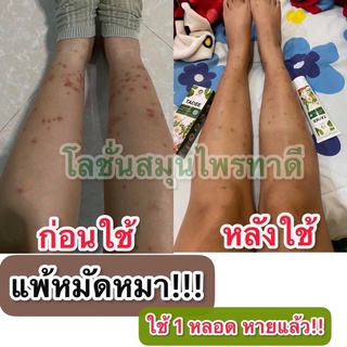 ภาพขนาดย่อของภาพหน้าปกสินค้าTadee โลชั่นแก้คัน แก้ปัญหาโรคผิวหนังทุกชนิด จากร้าน numprikmangdauthai บน Shopee ภาพที่ 7