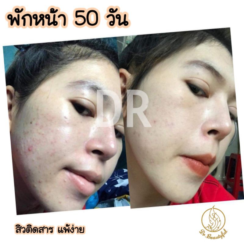 สบู่ดีอาร์-dr-soap-thailand