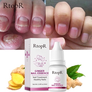 RtopR FDA ยาทาเล็บป้องกันเชื้อแบคทีเรีย รักษาโรคเชื้อราที่เล็บ เล็บพัง ดูแลเล็บ 10 มล.