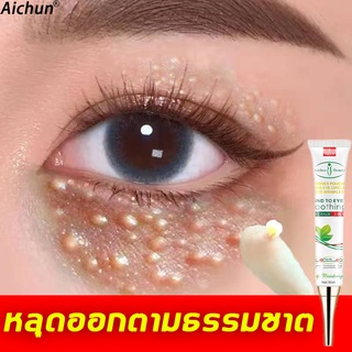 Aichun เม็ดไขมัน 30ml ลบคล้ำบวมใต้ตา กระชับรอยตีนกา ลดเม็ดไขมัน ฟื้นฟูผิวตา ครีมทารอบดวงตา เซรั่มอายครีม อายครีม