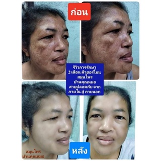 ภาพขนาดย่อของภาพหน้าปกสินค้า( สินค้าหมด ) /สลายฝ้า/อกฟูรูฟิต/รักษามดลูก/หลังคลอด ยาต้มสมุนไพรสตรีว่านมหาเสน่ห์(สูตรกู้ร่าง) ค่าส่งถูก จากร้าน bumbimmed บน Shopee ภาพที่ 4