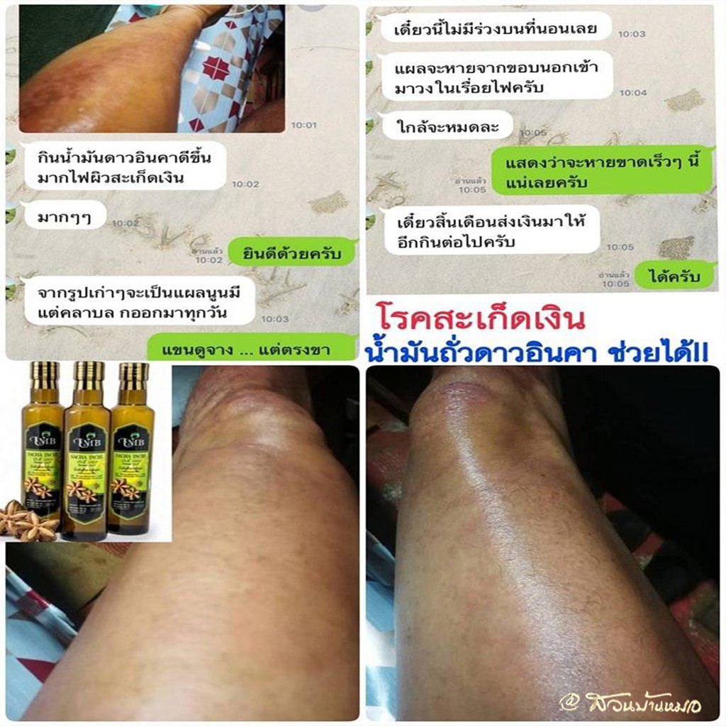 ภาพสินค้าน้ำมันถั่วดาวอินคา สกัดเย็น แบบขวด UMB Sacha Inchi Oil (Omega) 500 ml. 2 ขวด สินค้าพร้อมส่ง จากร้าน siam369 บน Shopee ภาพที่ 4