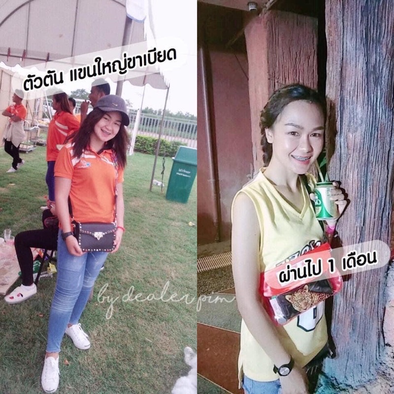 โปร2แถม2เนฟิลิมสำหรับดื้อยาเงินแท้100