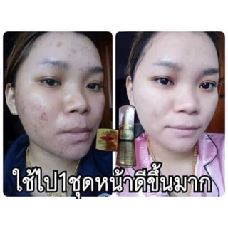 CHARMING SKIN ครีมบำรุงผิวหน้า หน้าขาวใส