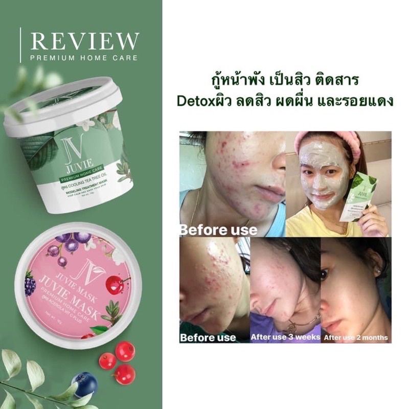 พร้อมส่ง-juvie-mask-จูวี่มาร์ก-มาร์กหน้าใส-ลดสิว-รักษาสิวอุดตัน-มาร์กหน้าสูตรคลีนิค-ปลอดภัย-มี-อย-ของแท้100