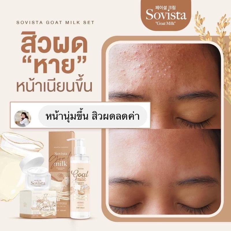 sovista-goat-milk-cleansing-คลีนซิ่งโซวิสต้า-นมแพะ-135-ml-ขวด