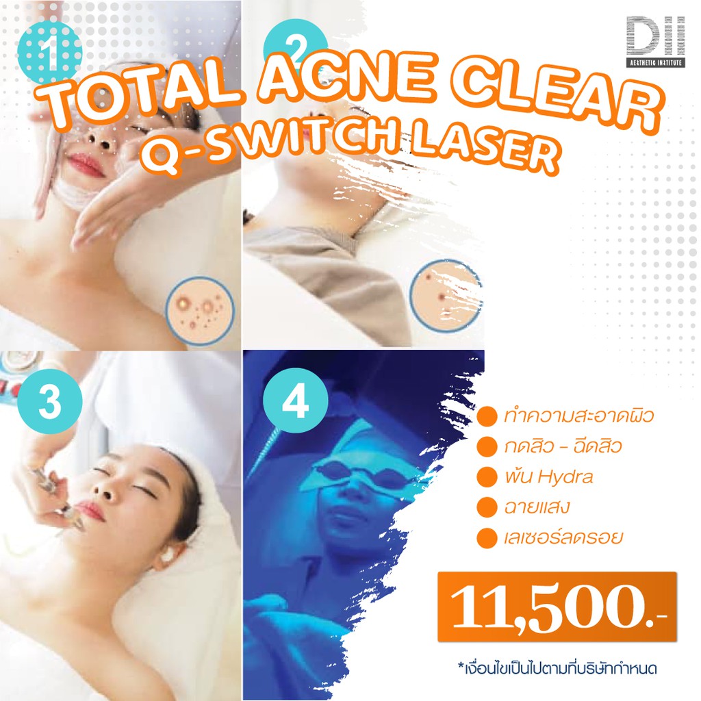 dii-aesthetic-total-acne-clear-q-switch-laser-1time