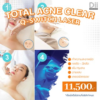 Dii Aesthetic : Total Acne Clear + Q-Switch Laser 1Time