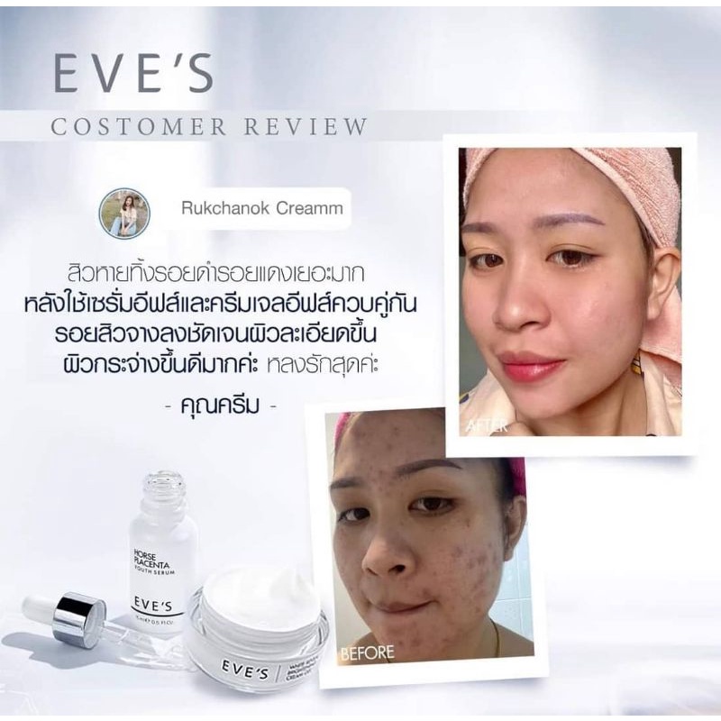 eves-ส่งฟรี-เซรั่มอีฟส์-ครีมเจลอีฟส์-ผิวใส-เซ็ตหน้าใสไร้สิว-เซรั่มรกม้า-ลดรอย-ผิวขาวกระจ่างใส-eves-ลดเลือนริ้วรอย-ครีม