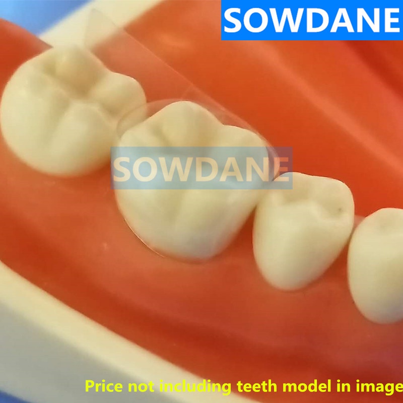 dental-self-adhesive-transparent-sectional-contoured-matrix-twin-anterior-matrice-matrix-for-premolar-molars-polyester-m