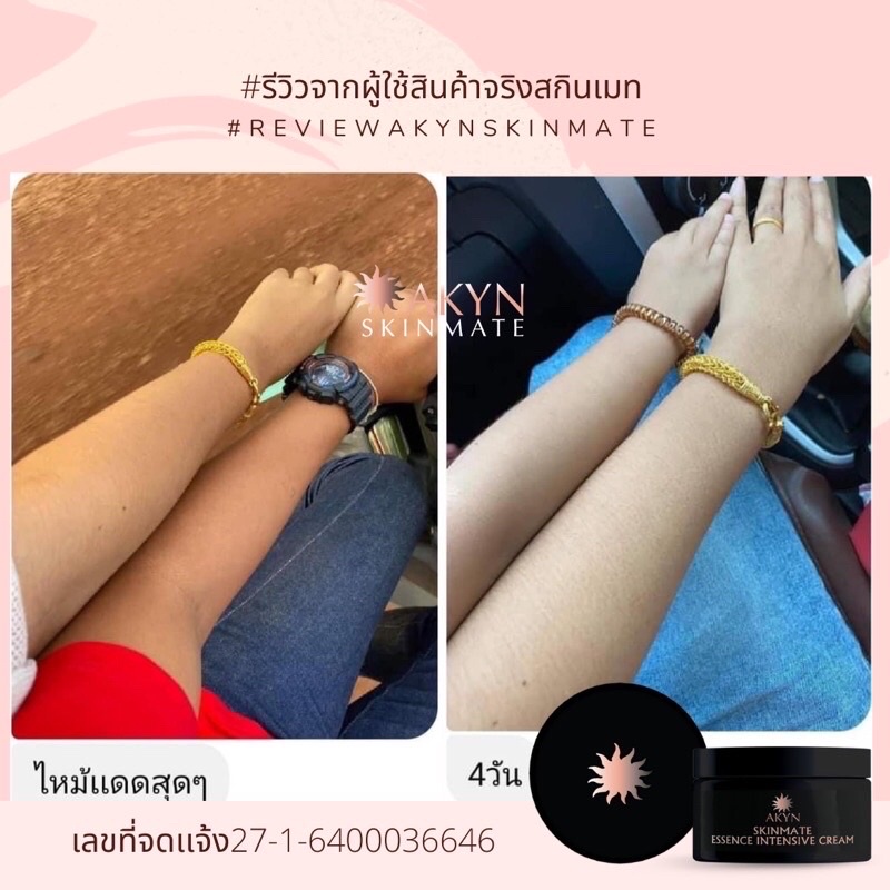 ครีมทาตัวขาวสูตรเข้มข้น-ขาวจริงขาวไว-ผิวไม่บาง-ไร้สารต้องห้าม-อคิน-สกินเมท